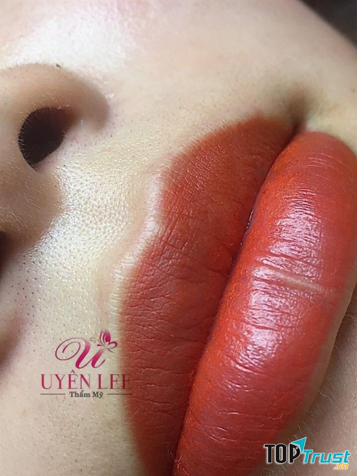 Thẩm mỹ Uyên Lee