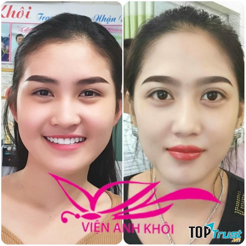 Thẩm Mỹ Viện Anh Khôi