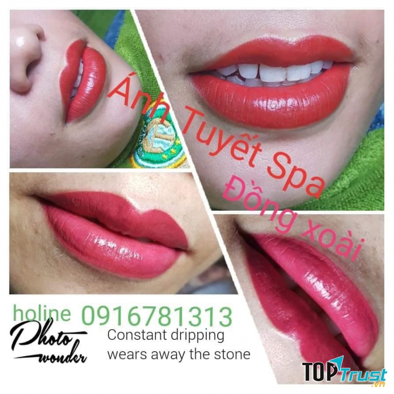 Thẩm mỹ viện Ánh Tuyết