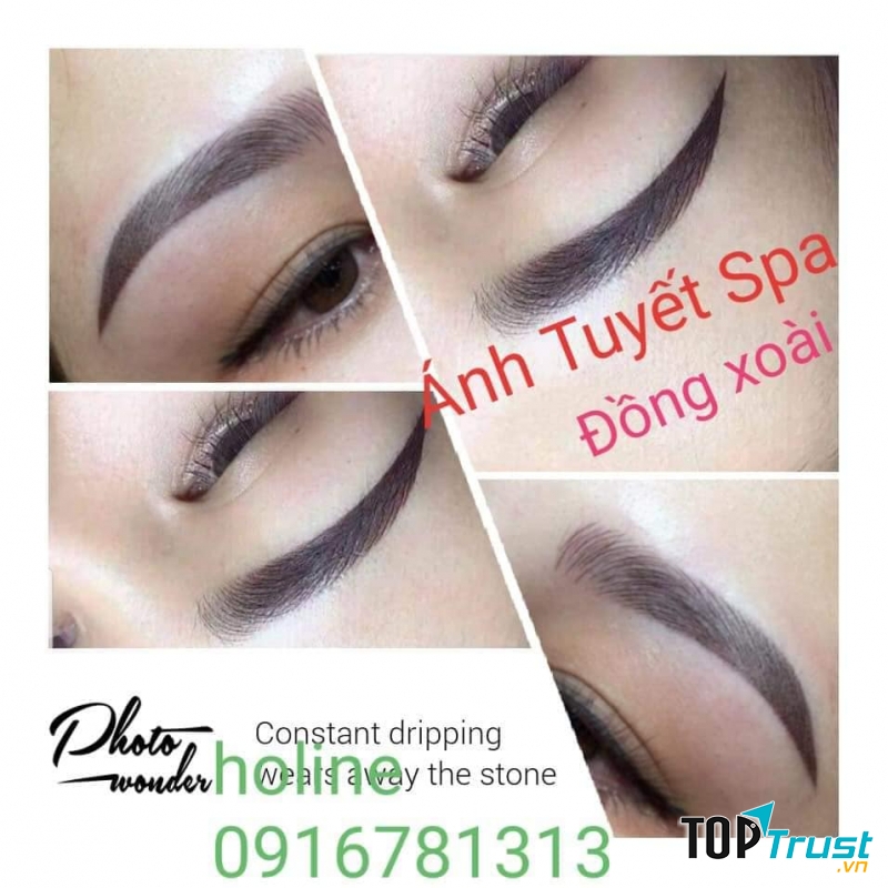 Thẩm mỹ viện Ánh Tuyết