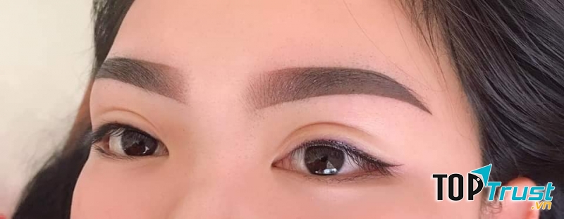 Thẩm Mỹ Viện Ánh Tuyết