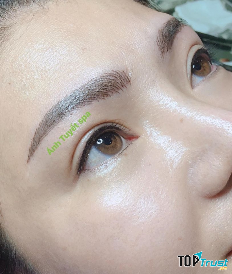 Thẩm Mỹ Viện Ánh Tuyết