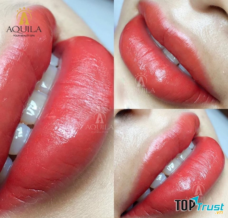 Thẩm Mỹ Viện Aquila