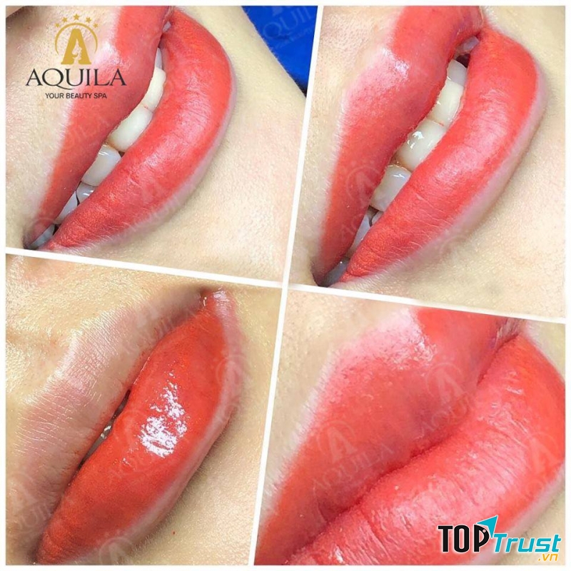 Thẩm Mỹ Viện Aquila