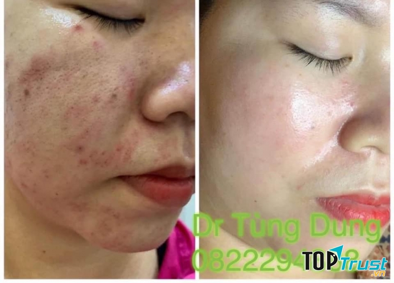 Thẩm Mỹ Viện Bác sĩ Tùng Dung