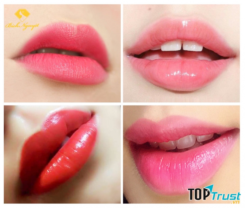 Thẩm Mỹ Viện Bích Nguyệt