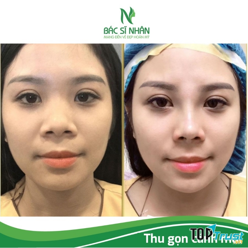 Thẩm Mỹ Viện BS Nhân