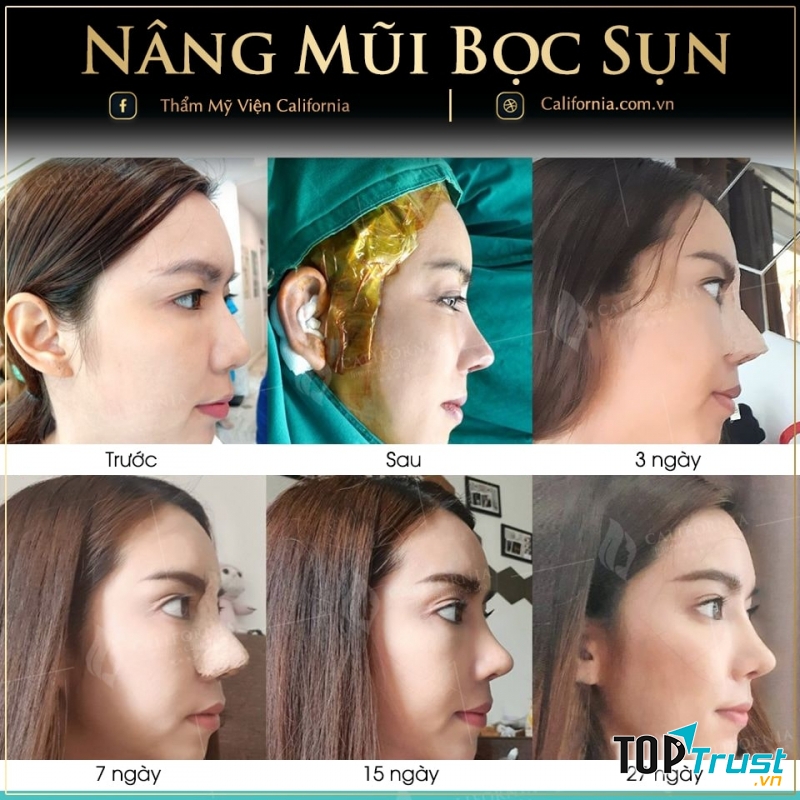 Thẩm Mỹ Viện California