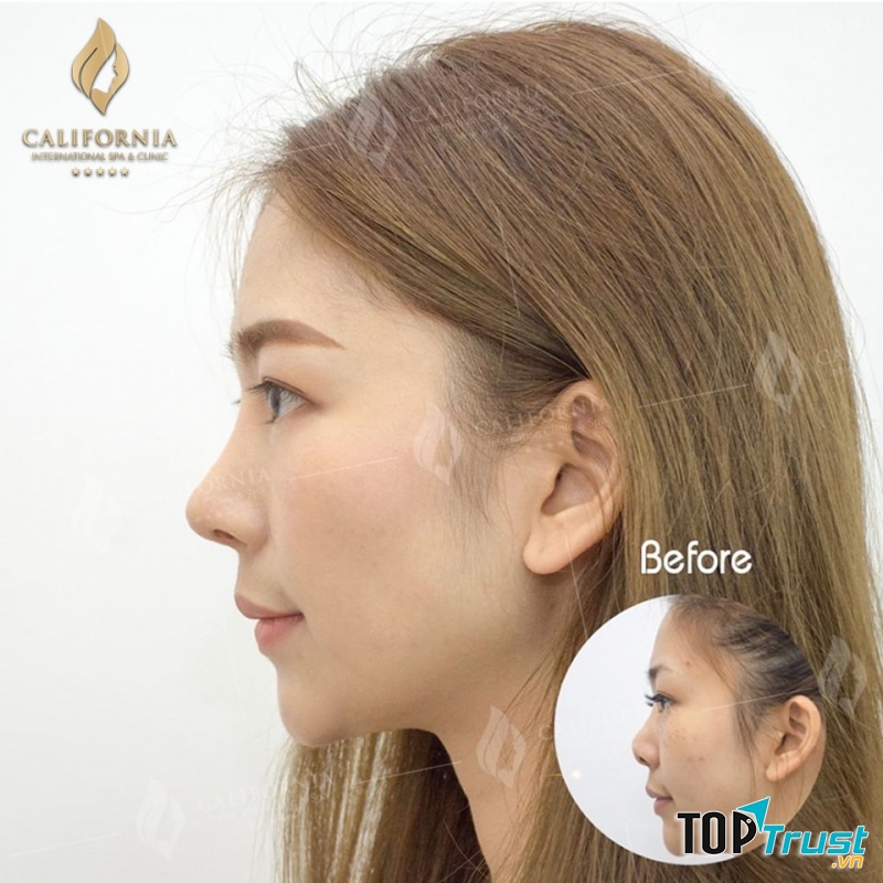 Thẩm Mỹ Viện California