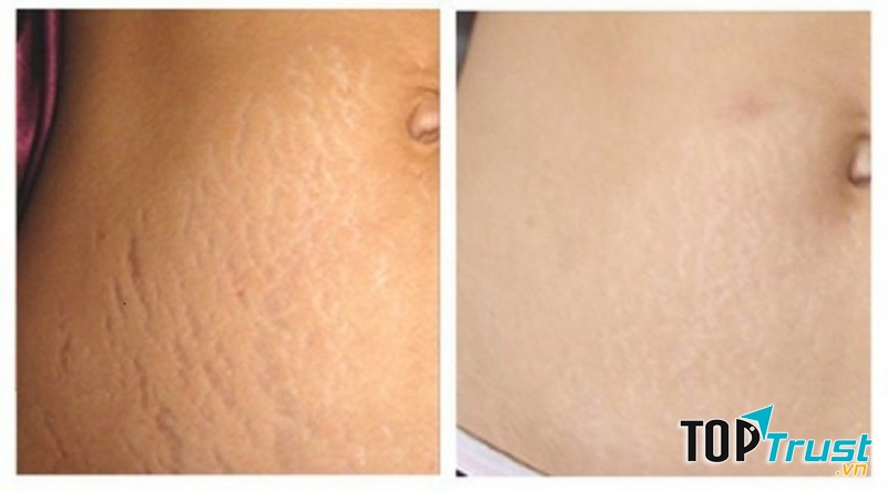 TMV châu Á Sài Gòn