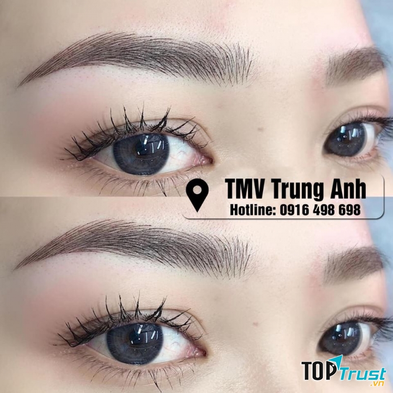 Thẩm Mỹ Viện Công Nghệ Cao Trung Anh