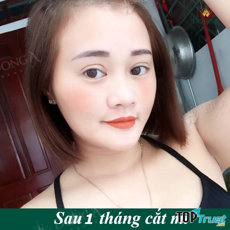 Thẩm Mỹ Viện Đông Á - địa chỉ nhấn mí mắt đẹp và an toàn nhất ở TP. HCM