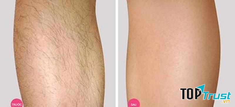 Violong không còn đeo bám