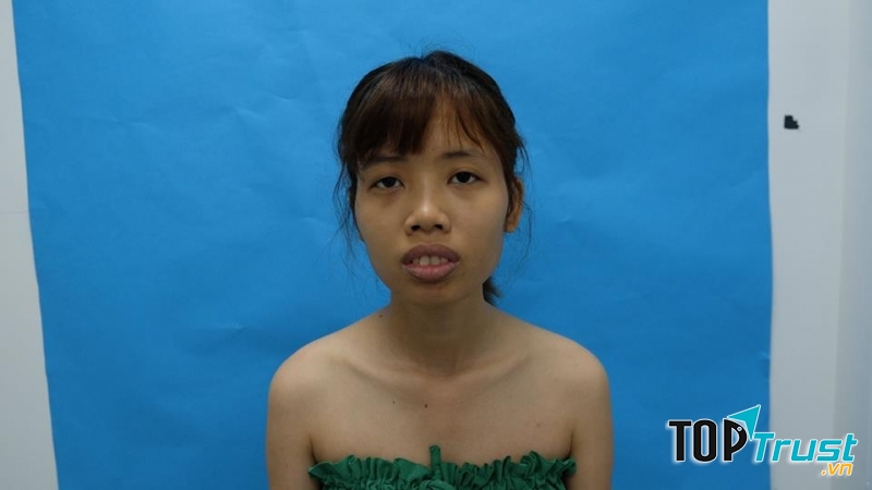 Bệnh Viện Thẩm Mỹ Đông Á