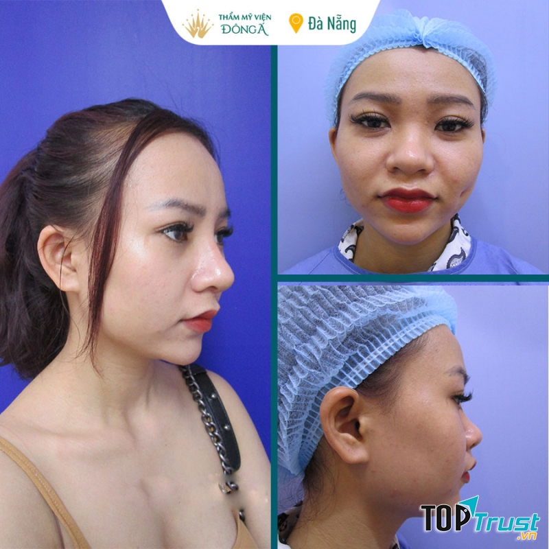 Thẩm mỹ viện Đông Á