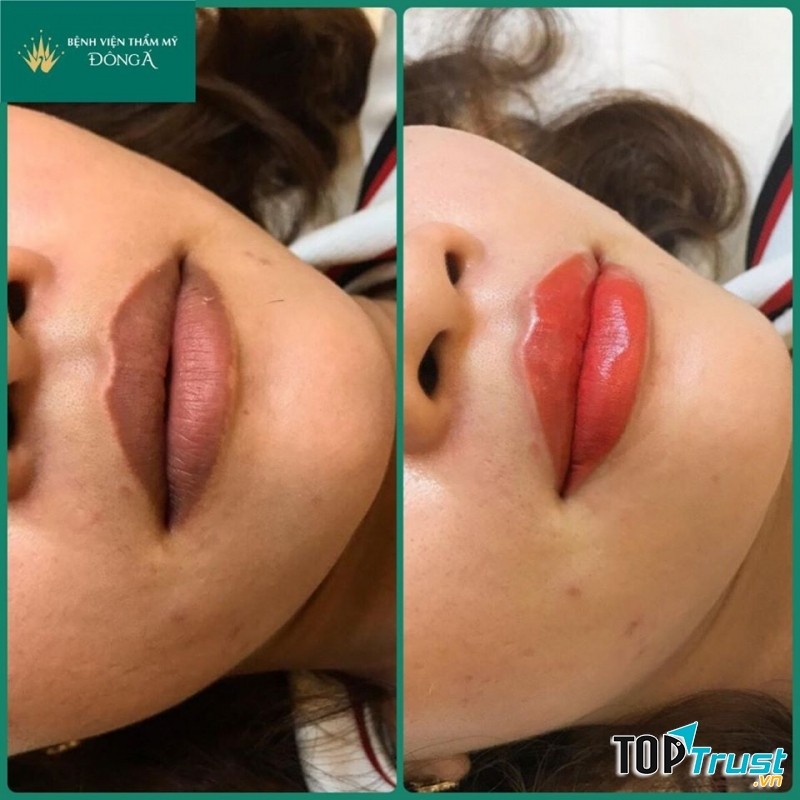 Thẩm mỹ viện Đông Á