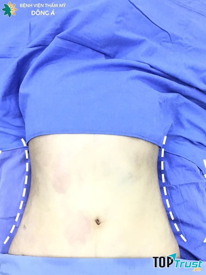 Thẩm mỹ viện Đông Á