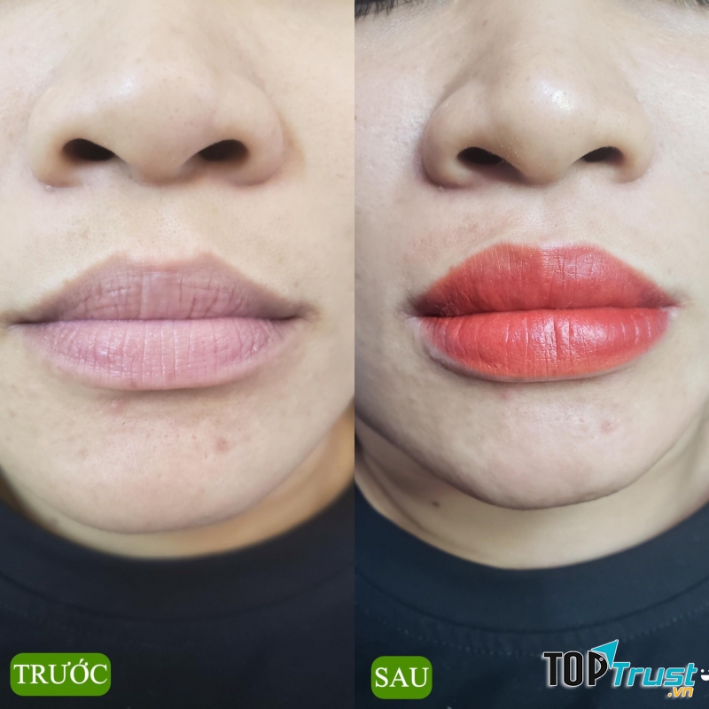 Thẩm Mỹ Viện Đông Á (Đà Nẵng)