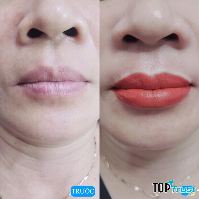 Thẩm Mỹ Viện Đông Á (Đà Nẵng)