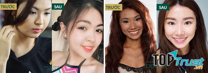 QUY TRÌNH TẮM TRẮNG LIỆU TRÌNH WHITE PLUS