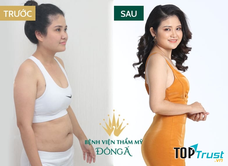 Thẩm mỹ viện Đông Á Đà Nẵng - Đơn vị thẩm mỹ uy tín tại nước