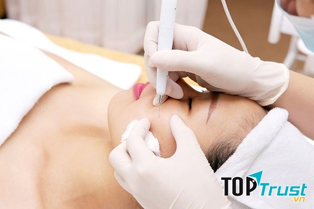 Khách hàng tẩy mụn ruồi tại TMV Đông Âu