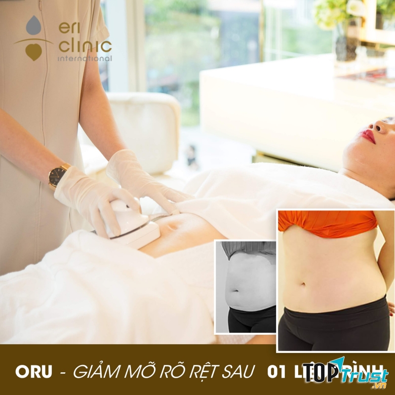 Thẩm mỹ viện Eri International