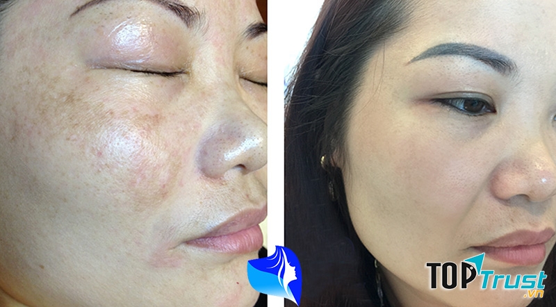 T﻿hẩm Mỹ Viện Gangnam