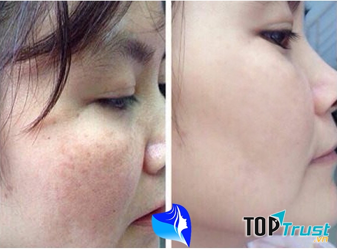 T﻿hẩm Mỹ Viện Gangnam