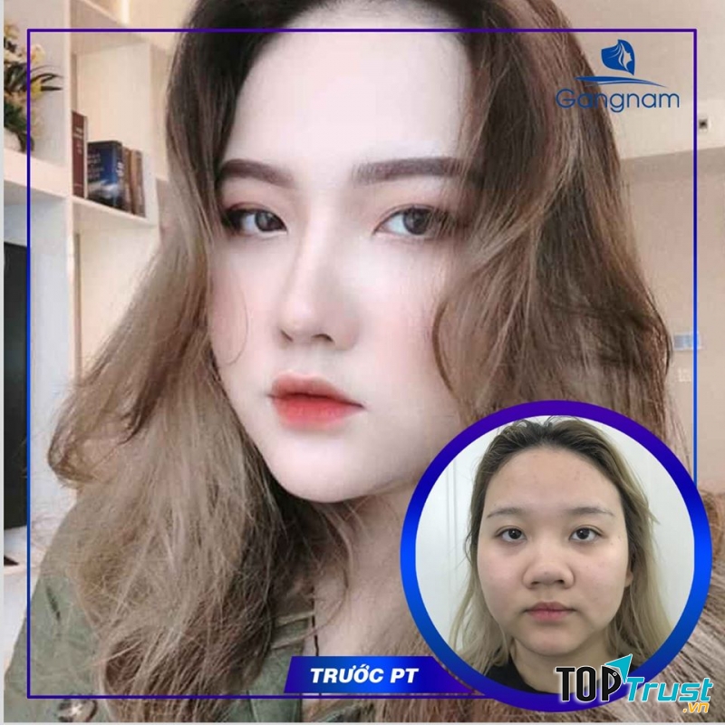 Thẩm mỹ viện Gangnam