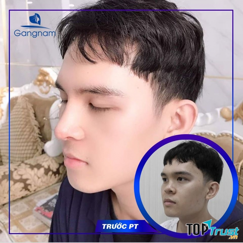 Thẩm mỹ viện Gangnam