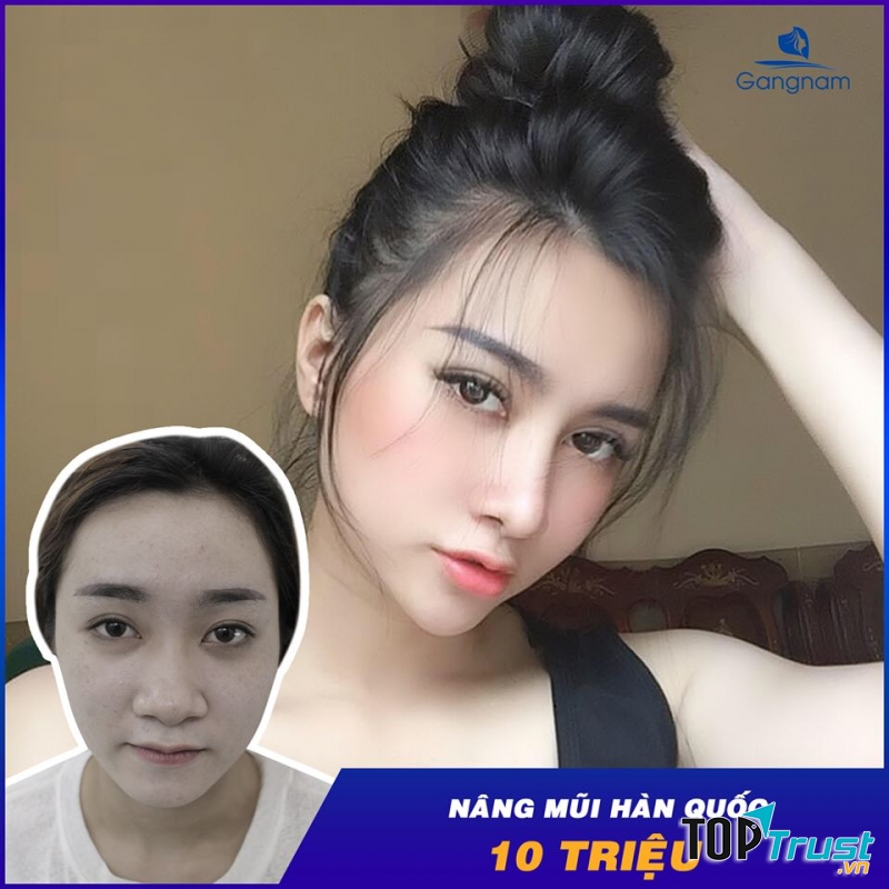 Thẩm Mỹ Viện Gangnam