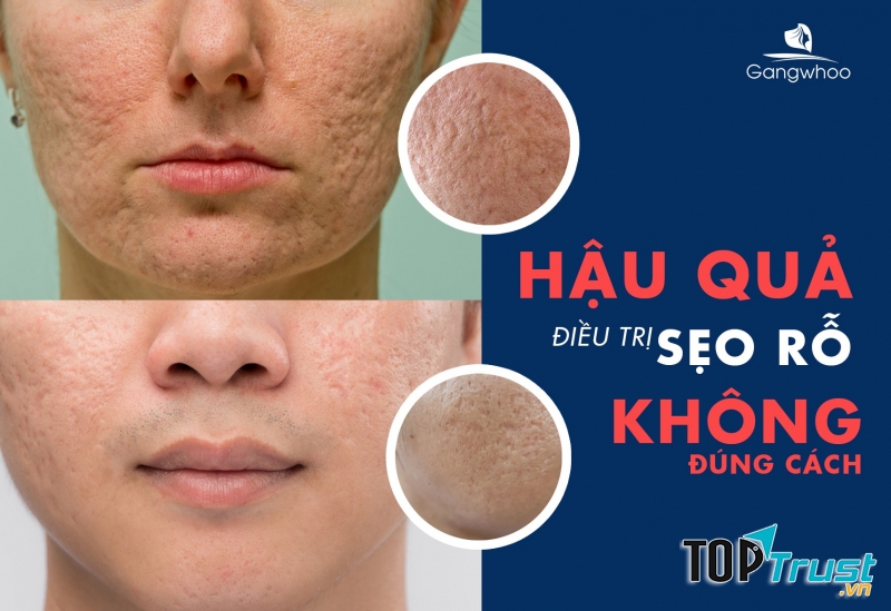 Thẩm Mỹ Viện Gangwhoo