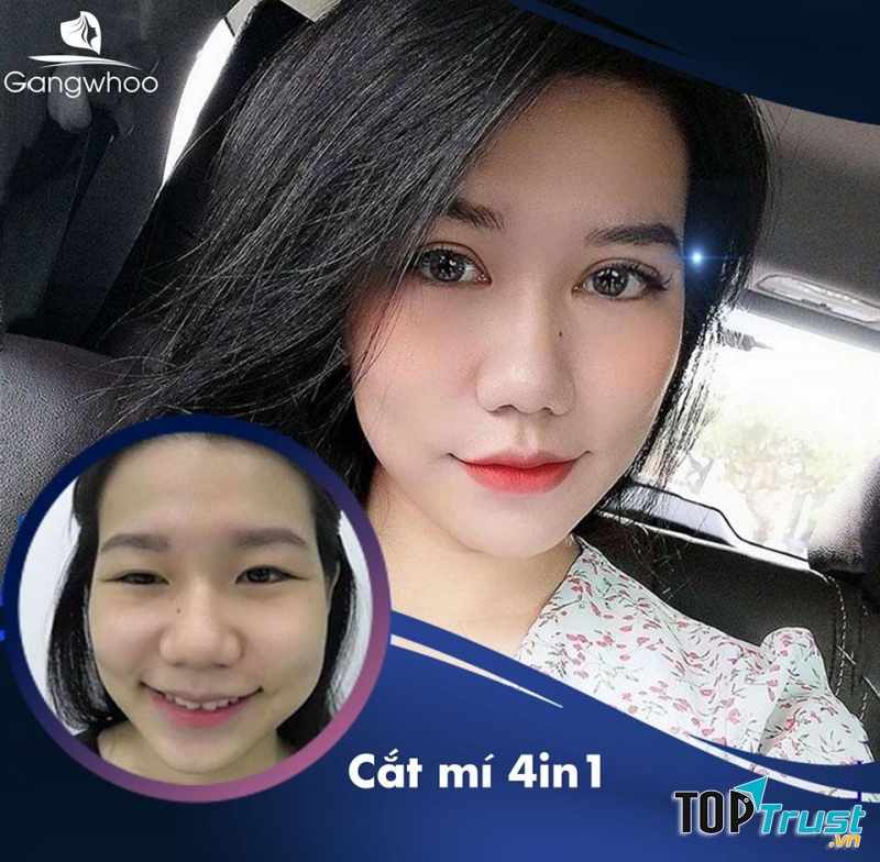 Thẩm mỹ viện Gangwhoo