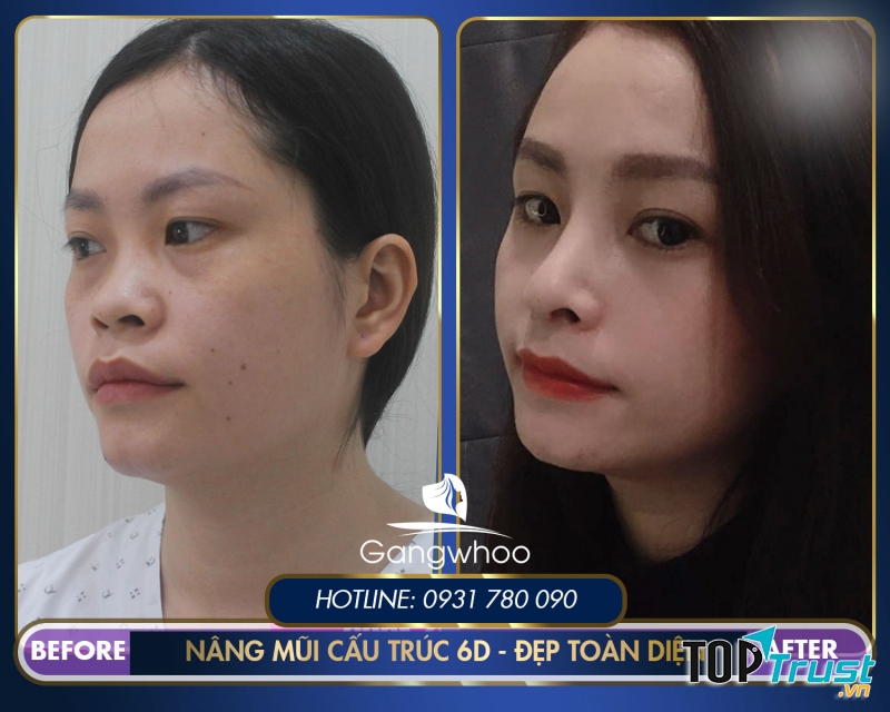 Thẩm mỹ viện Gangwhoo