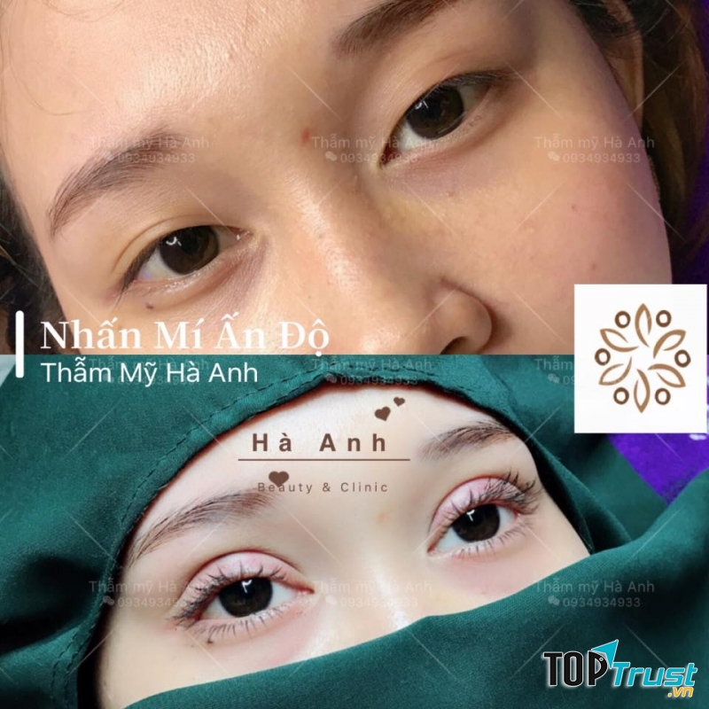 Thẩm mỹ viện Hà Anh