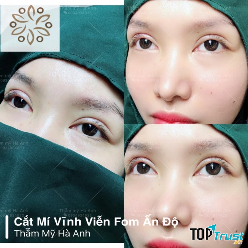 Thẩm mỹ viện Hà Anh