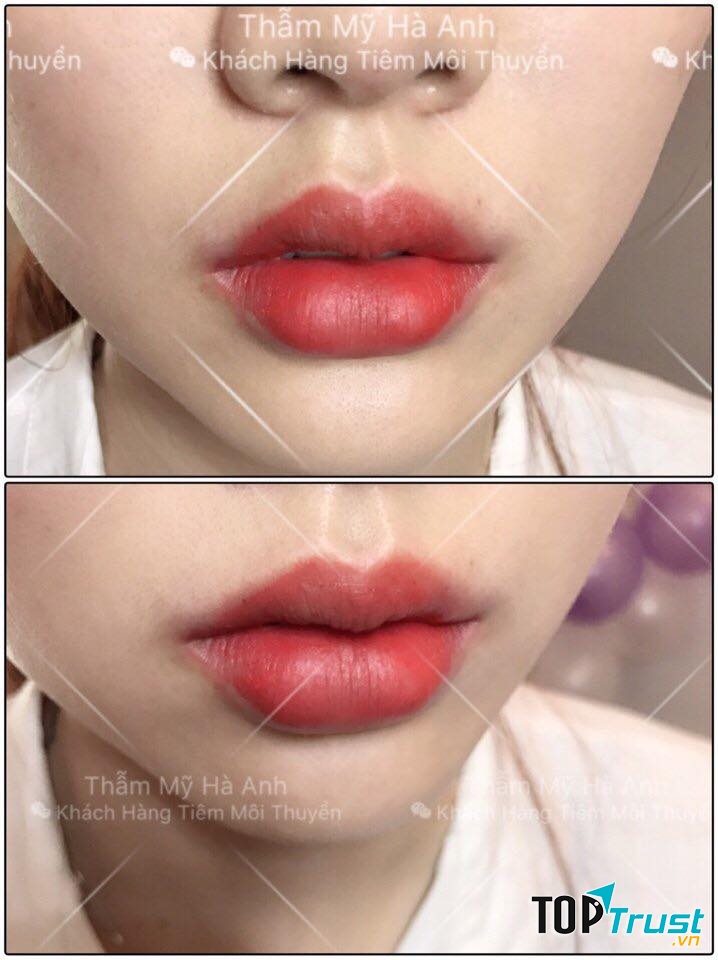 Thẩm Mỹ Viện Hà Anh