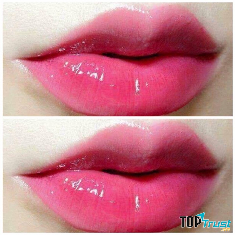 Thẩm Mỹ Viện Hà Hương