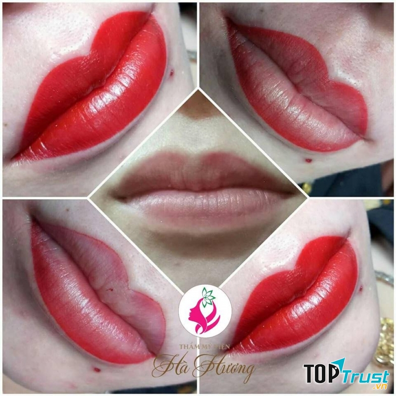 Thẩm Mỹ Viện Hà Hương