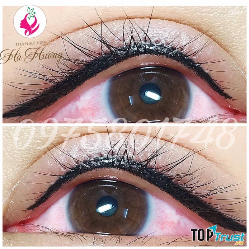 Thẩm Mỹ Viện Hà Hương