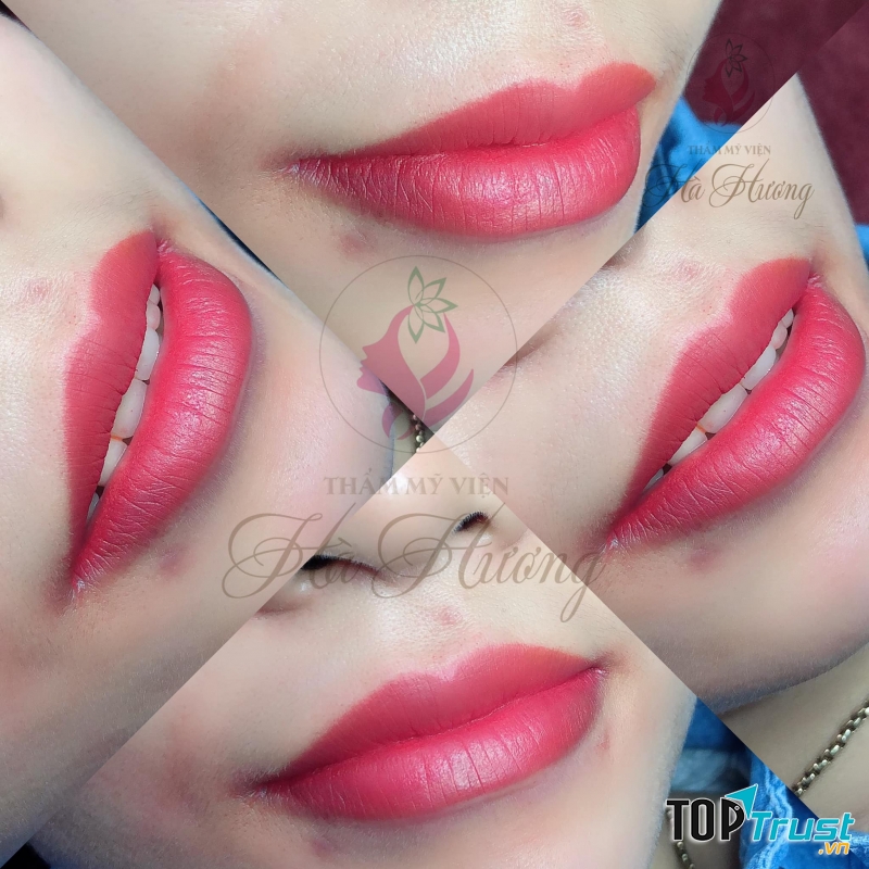Thẩm Mỹ Viện Hà Hương