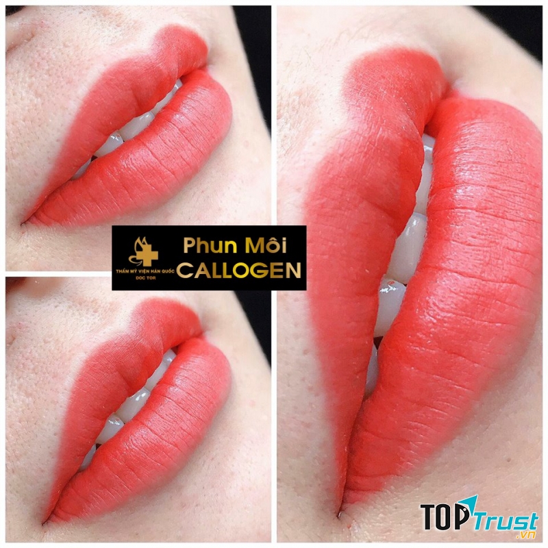 Thẩm Mỹ Viện Hàn Quốc