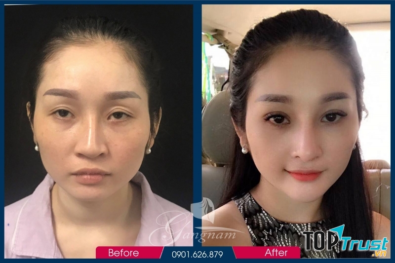 Thẩm Mỹ Viện Hàn Quốc Gangnam