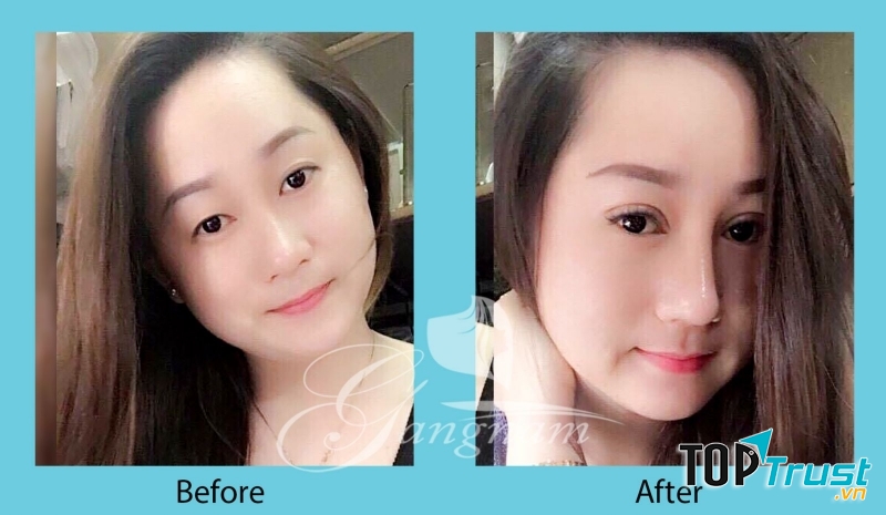 Thẩm Mỹ Viện Hàn Quốc Gangnam