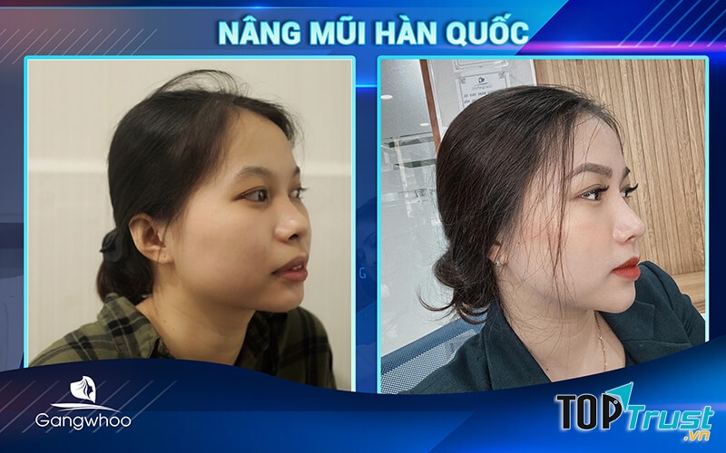 thẩm mỹ viện Hàn Quốc Gangwhoo