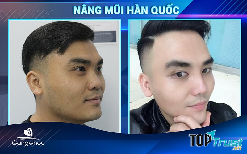 thẩm mỹ viện Hàn Quốc Gangwhoo