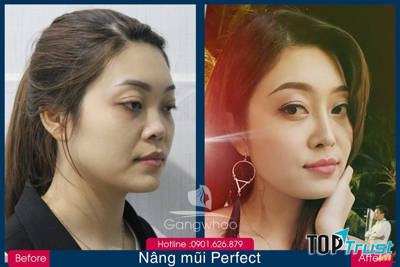 Thẩm mỹ viện Hàn Quốc Gangwhoo