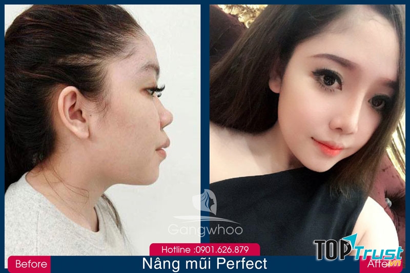 Thẩm mỹ viện Hàn Quốc Gangwhoo