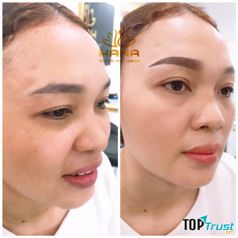 Thẩm Mỹ Viện Hana